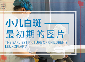 孩子背后長(zhǎng)白斑怎么辦,不同時(shí)期的病發(fā)表現(xiàn)是怎樣的(要做什么檢查)