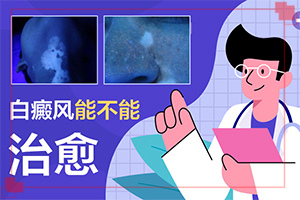 [應該如何治療]陰道白班怎么治