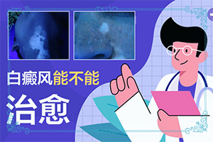 為什么五六歲時(shí)臉蛋上有白斑呢,發(fā)生的原因是什么(為什么會(huì)出現(xiàn)白癜風(fēng))