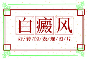 身上長白班怎么辦,具體表現(xiàn)有哪些(如何診斷)