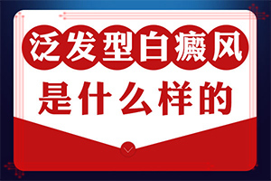 [如何科學(xué)地治療]白點(diǎn)癲風(fēng)能不能治好嗎