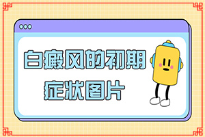 白癲的早期癥狀治療,有哪些癥狀需要知道(發(fā)作有什么癥狀)