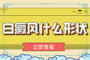 白癩風有什么癥狀嗎?,都有哪些癥狀表現(xiàn)呢(表現(xiàn)癥狀是啥)