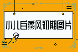 小肚子有白斑是怎么回事-發(fā)病的原因是什么