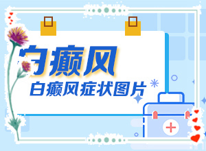 皮膚白斑-好發(fā)部位有哪些(如何正確區(qū)分)