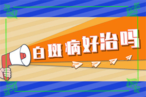 白癩風(fēng)多久能,怎么控制才好(需要做哪些準(zhǔn)備)