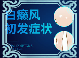 孩子夏天臉上有白斑是什么原因,發(fā)病的原因有哪些(什么原因會誘導(dǎo)白斑)