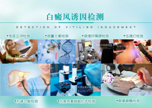 白癜風(fēng)檢查