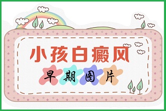 白點(diǎn)風(fēng)患者怎么樣調(diào)整好自身的情緒
