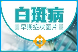 「輕度白癩風癥狀」有效的預防的措施有哪些?