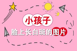 白癩風(fēng)患者可以使用遮蓋液?jiǎn)?遠(yuǎn)離不利因素才是重點(diǎn)