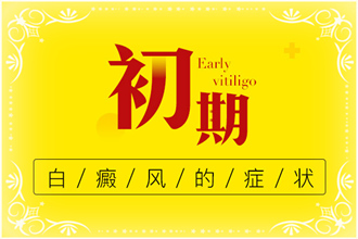 一分鐘了解白癩風初期什么樣子