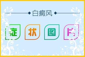 甕安縣白點風(fēng)患者頸部患病注意哪些!