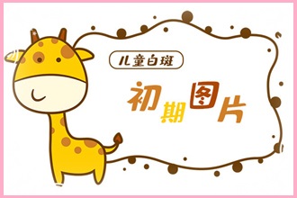 這些因素影響白點風看好需要