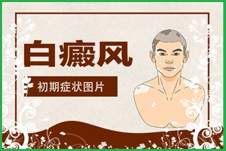 白癩風(fēng)遮蓋液去哪家買(mǎi)好，什么牌子的比較好用呢