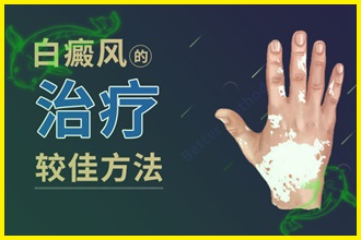 白顛風(fēng)怎么治療好的快-檢查病因、制定方法、防護三步走