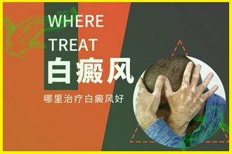 白癲風(fēng)的早期癥狀圖片避免擴(kuò)散，這些措施要一一執(zhí)行