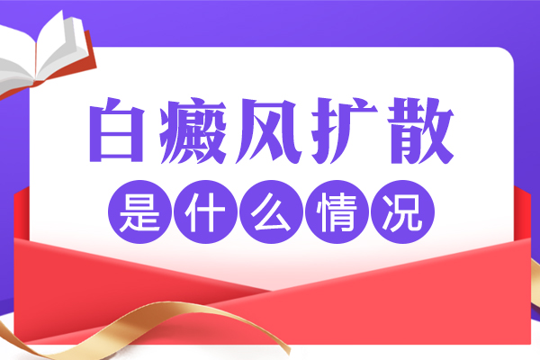 白癜風(fēng)擴(kuò)散期間,患處會(huì)瘙癢嗎？白斑擴(kuò)散的癥狀是什么？