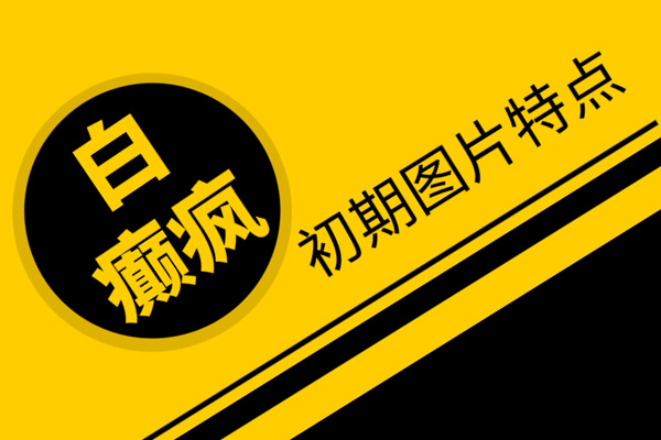【科普速遞】臉上出現白斑/白點是怎么回事,會是白癜風嗎