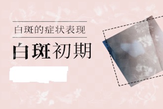 遵義身上有[白癜風(fēng)]白斑圖片居然擴(kuò)散了-什么原因引發(fā)的呢