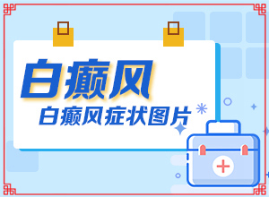 白癩風是什么形狀的,有什么特點(主要臨床癥狀是什么)