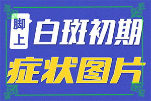 八個(gè)月的寶寶肚子上有白斑怎么治療（診療有嗎）