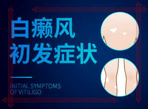 治療白癲瘋醫(yī)院[如何診斷和治療]手上長白斑用什么藥擦好