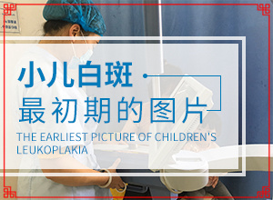 白顛瘋可以醫(yī)治嗎-[分析]不如試試這種方法