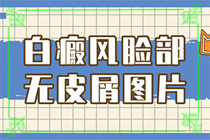 白班用什么藥涂[如何輔助治療呢]兒童白點癲風可以治好嗎