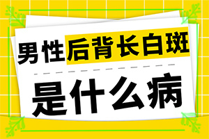 白班的治療方法,診治的方法有哪些(如何能讓白癜風早日治療好)