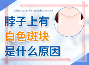 臉上白斑是什么原因，如何解決,什么原因會(huì)誘導(dǎo)白斑(常見原因)