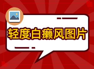 白點(diǎn)癲風(fēng)治療費(fèi)用[用什么方法治]初期白癩風(fēng)可以治嗎?