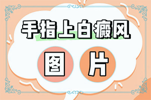 白癩風(fēng)圖片早期圖片,常見癥狀有什么特點(有什么區(qū)別呢)