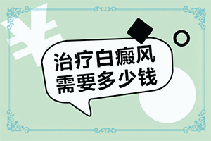 臉上有白斑怎么回事一塊一塊的？白斑是怎么形成的-常見病因有哪些