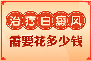 白點癲風(fēng)的圖片早期,怎么檢查呢(白斑剛出現(xiàn)是啥樣)