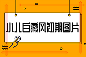 白癲風怎么治療[治白斑怎么治好得快]遺傳白巔峰治療法