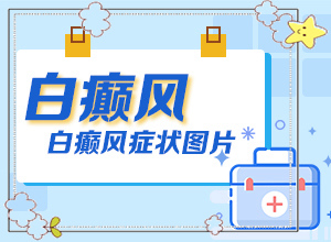 兒童白顛風早期癥狀,剛患上了都有哪些癥狀表現(xiàn)呢(診斷依據(jù))