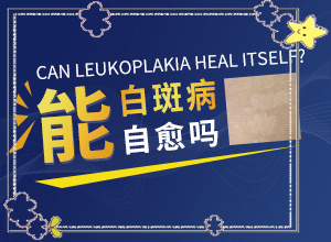 [醫(yī)治白斑原則有]兒童白點癲風可以治好嗎