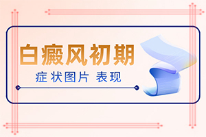 白癩風(fēng)能治嗎[治療咋樣呢]小孩白點癲風(fēng)能嗎?