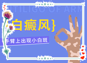 白點癲風(fēng)癥狀圖片,有什么變化(各個時期有什么癥狀)