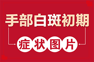 輕度白癩風(fēng)早期,如何自我診斷(發(fā)病后會(huì)出現(xiàn)哪些表現(xiàn))