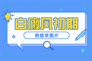 孩子臉上白班怎么辦,診斷方法是不是(好轉(zhuǎn)的表現(xiàn)是什么)