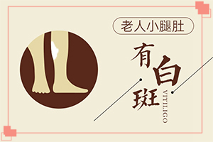 怎樣治療白癲瘋,如何治療好(對(duì)白癜風(fēng)的治療有幫助嗎)