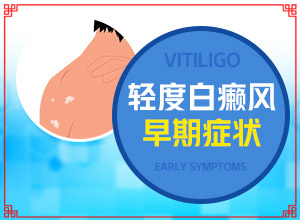 白癩風前期癥狀是什么,具體表現(xiàn)是哪些(如何知道白斑是否為白癜風)