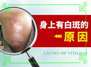 為什么臉上出現(xiàn)一塊白斑,白斑誘發(fā)什么有關(發(fā)作原因是哪些)