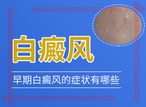 三歲的孩子臉上長白斑怎么回事,發(fā)生的原因是什么(出現(xiàn)后該怎么辦)