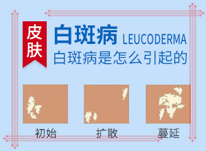 早期白癩風(fēng)的圖片,表現(xiàn)癥狀是啥(怎么判斷)