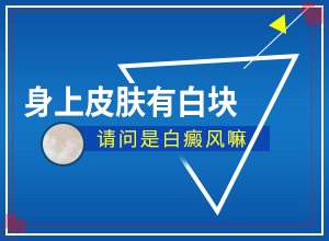 哪些緣由導(dǎo)致白癜風-手背上有白斑是什么原因引起的