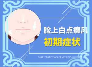 為什么會(huì)白殿風(fēng),導(dǎo)致的因素有哪些(白斑的因由是哪些)
