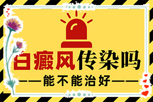 白顛瘋怎樣才能?[不同類(lèi)型白斑怎么辦]肢端白斑好的治療方法